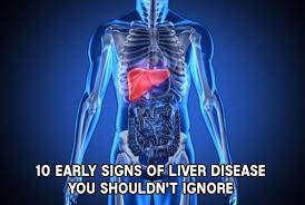 10 Early Signs Of Liver Disease You Shouldn T Ignore Mental Scoop Liver Disease Liver Disease Symptoms Bile Duct Cancer