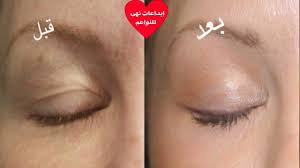 كولاجين طبيعي قوي لشد ورفع الجفون وعلاج التجاعيد كريم سحري يخلصك من ترهلات الجفون youtube