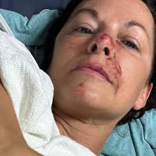 Fundraiser for Natasha Johnson by Shanna Crist : Support Natasha's Recovery  Journey