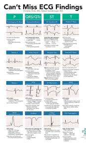 A High Yield On Shift Resource To Help Emergency Department Providers Spot Subtle High Risk Ecg Emergency Nursing Cardiology Nursing Nursing School Survival