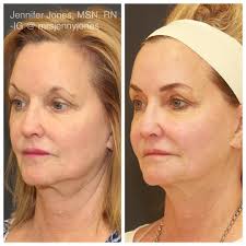 Nayak Plastic Surgery