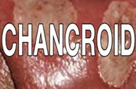 Image result for chancroid