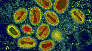 Monkeypox is caused by monkeypox virus, a member of the orthopoxvirus genus in the family poxviridae. How Canadian Researchers Reconstituted An Extinct Poxvirus For 100 000 Using Mail Order Dna Science Aaas