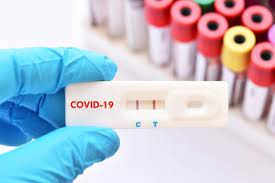 Caseta test rapid antigen coronavirus este un test de diagnostic in vitro pentru detectarea calitativă a antigenilor noului coronavirus în tampon nazofaringian, utilizând metoda. Testele Antigenice Rapide