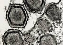 It does not affect humans nor does it affect other animal species other than pigs and wild boars. African Swine Fever Virus Mutations May Pose Detection Challenges Pork Business