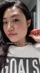 Nikko Cheecks Whitehead