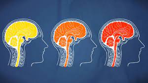 What happens to your brain when you have a headache. How To Tell If It S A Headache Migraine Or Brain Aneurysm And What To Do Next National Globalnews Ca