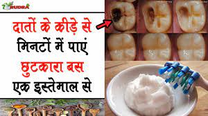 Often we are warned to stay away from sugary food since our childhood. How To Get Rid Of Tooth Cavity At Home 100 Effective Rudra Home Remedies Youtube