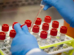 Any rapid testing appointments made within 90 days of a positive test will be canceled. Rajasthan Ceases Use Of Rapid Testing Kits As Most Results Invalid The Economic Times