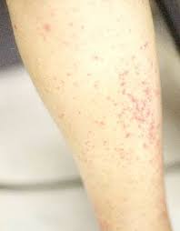 Your Child Has A Rash Do You Know What To Do Rashes In Children Kids Health Kids Fever