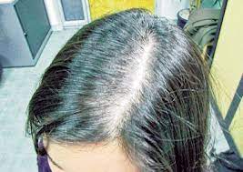 Produk hair bleaching yang bagus tentu harus bisa melindungi rambut juga supaya tidak rusak. 20 August 2010 Sitik S Blog Page 2