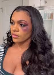Shayla must forgot Amber gave her a black eye 👁️