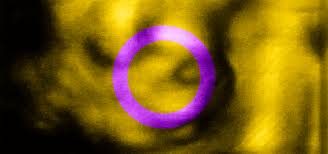 Any of a variety of inherent conditions (in a dioecious species). Intersex Is Not Exactly Breaking News Kosovo 2 0