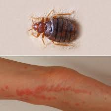 We did not find results for: Piqures D Insectes Comment Reconnaitre Quel Insecte Vous A Pique