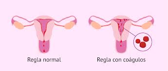 Por Que Salen Coagulos De Sangre En La Menstruacion