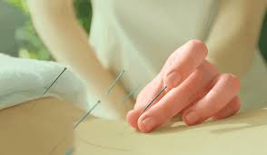 Image result for Acupuncture