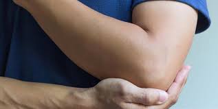 Tendonit Nedir Nasil Gecer Tendonit Kimlerde Gorulur