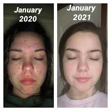 Jill Simms (@aloenaturalbyjill) • Instagram photos and videos