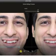 PDF) The Art of Dental Simulation Treatment Using the Artificial  Intelligence