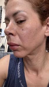 Buy Merikit Revital Mask (1EA) Online