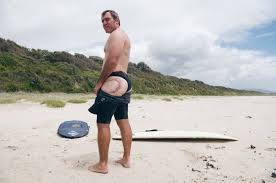 Suspected shark attack in port macquarie leaves teenager with bitten finger, foot and upper leg. Shark Attack Survivor Port Macquarie Engineer And Surfer Dale Carr Port Macquarie News Port Macquarie Nsw