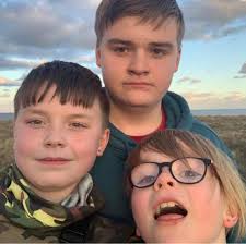 Any recommendations for best treatment for sunburn please. Thanks