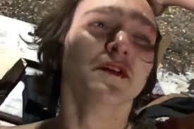 Fundraiser by Madison Davis : HELP 15YO PETER GET HIS TEETH REPLACED