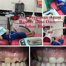 We offer braces, extraction, wisdom tooth, dental implant, cabut gigi, tampal gigi. Klinik Pergigian Azura Bandar Dato Onn Jb Dental Clinic In Bandar Dato Onn