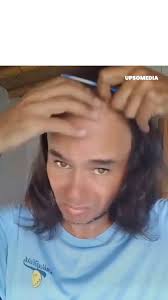 A young Peruvian man has gone viral with his solution to hide baldness.
