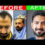 hair transplant in islamabad from www.hairclub.com.pk