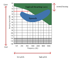 How Is Hearing Measured Discovery Of Sound In The Sea