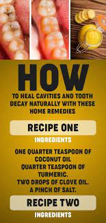 How To Heal Cavities And Tooth Decay Naturally With These Home Remedies Heal Cavities Cold Home Remedies Herbal Cure