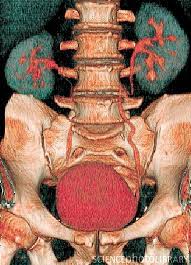 Kidneys And Bladder 3d Ct Scan Anatomy Physiology Muscular System Anatomy Human Body