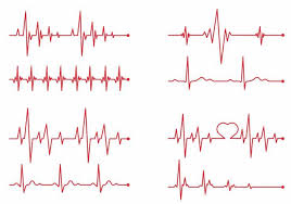 Heartbeat Monitor Grafikzeile Tatowierung Ekg Tattoo Herzschlag Tattoo Herzfrequenz Tattoo