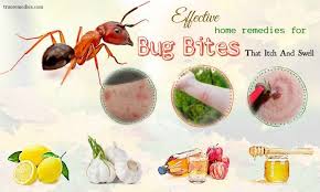 10 Effective Home Remedies For Bug Bites That Itch And Swell Bug Bites Remedies Bug Bites Home Remedies