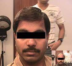 Sideparting Beforeandafter Hairwigs Naturalhairwigs Toupee Hairstyle Indian Srilankan Baldness Hair Wigs For Men Natural Hair Wigs Hair Care Solutions