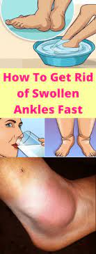 The Primary Material Used To Tailor The Garment Will Determine Its Durability And Comfort The Cotton Made Wea Swollen Ankles Swollen Feet Remedy Foot Remedies