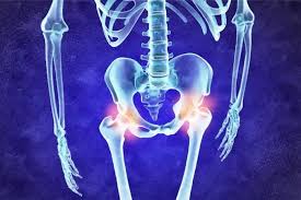 Osteoarthritis: Gene Study Finds New Drug Targets and Treatment Options