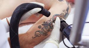When that runs out, you can use regular cotton pads and 70% isopropyl alcohol. Tattoo Removal Cream Does It Work Authoritytattoo