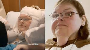 ‘1000-Lb Sisters:’ Tammy Slaton Unveils Transformation After Skin Removal  Surgery