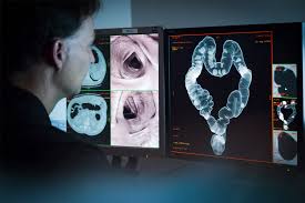 Coloscopie Virtuelle Radiologie Et Imagerie Medicale De La Capitale