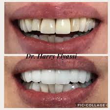 Successful dental care requires personalized treatment plans. Neo Dental Lab Home