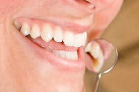 Maybe you would like to learn more about one of these? Dentist In Orlando Solves Microdontia With Restorations