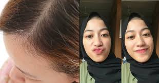 Check spelling or type a new query. 5 Cara Alami Hilangkan Anak Rambut Di Dahi Yang Suka Berdiri Biar Tampilan Jadi Lebih Rapi