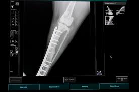 Microdicom — microdicom is application for primary processing and preservation of medical images in dicom format. Seeking A Dicom Viewer For Windows Read These Tips And Options Postdicom