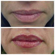 Lip Definition And Symmetry Regained With A Natural Soft Lip Blush Soft Lips Lip Blush Permanent Makeup Eyeliner