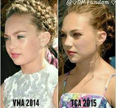 Maddie Then And Now Dm Fandom Dance Moms Hairstyles Mom Hairstyles Dance Moms