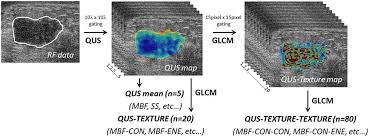 Trials are available for breast cancer prevention, screening, and treatment. Oncotarget Quantitative Ultrasound Radiomics Eurekalert