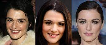 Hintergrundbilder described as rachel weisz facelift plastic surgery before und after fotos hinzugefügt von nil1. Rachel Weisz Plastic Surgery Before And After Pictures 2021