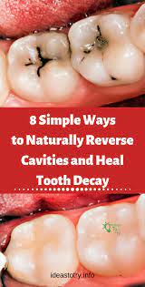 8 Simple Ways To Naturally Reverse Cavities And Heal Tooth Decay Reverse Cavities Heal Cavities Tooth Decay